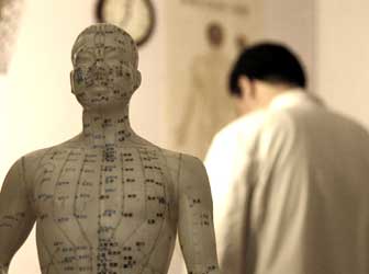 statuette acupuncture