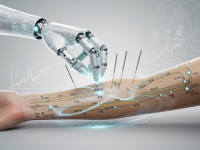 L' IA intervient de plus en plus d'ans l'acupuncture